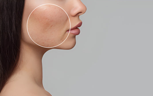 Understanding Different Types of Skin Tightening Devices: Which One is Right for You?